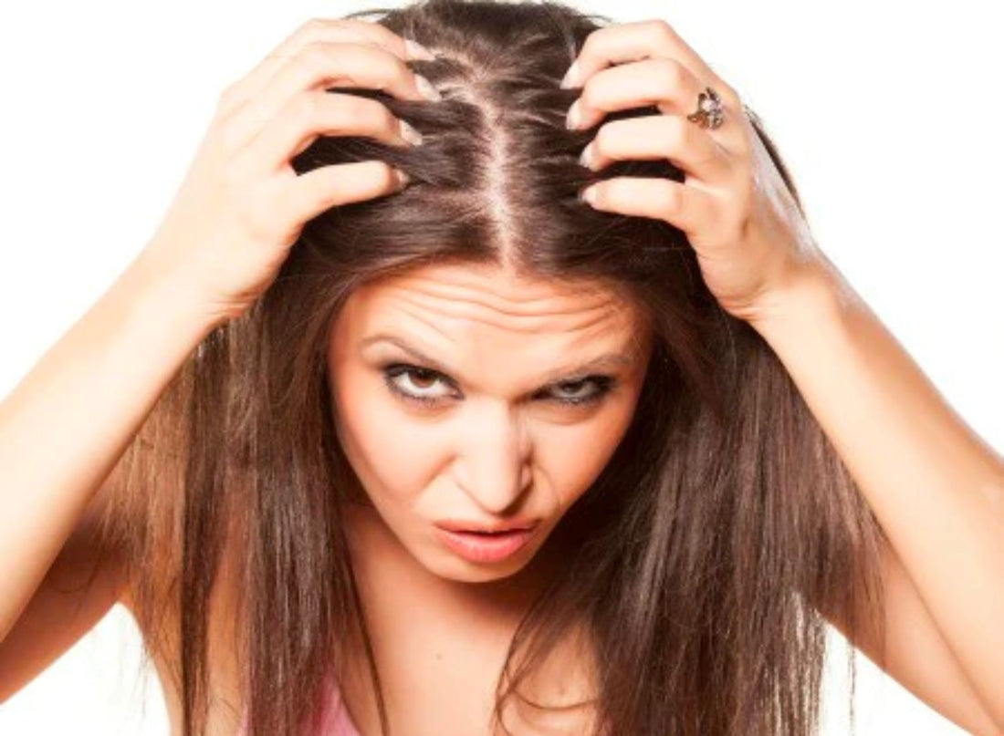 Have Dandruff? Learn About the Causes and How to Treat with Alodia's Natural Products - Alodia Hair Care