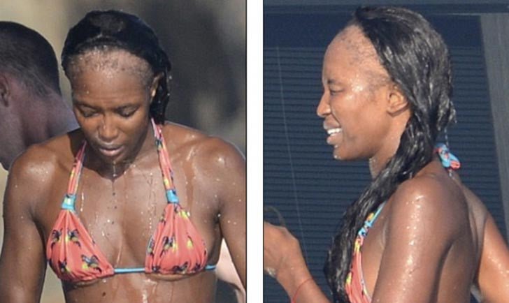 Traction Alopecia Information and How Alodia Hair Care Can Help - Alodia Hair Care