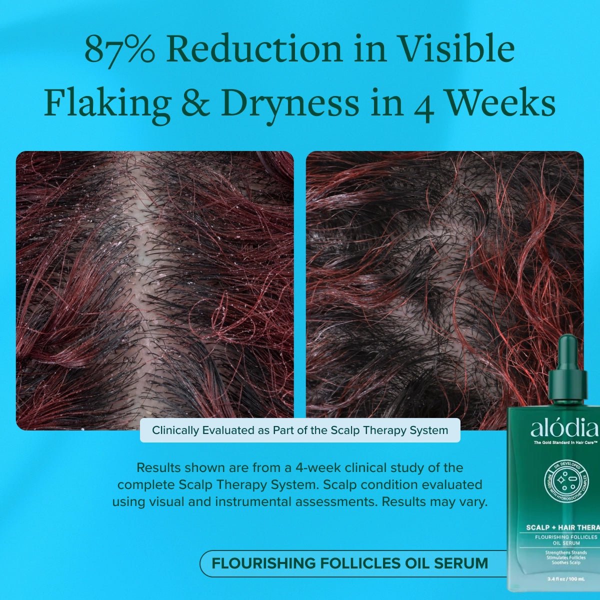 Flourishing Follicles Oil Serum - Alodia Hair Care