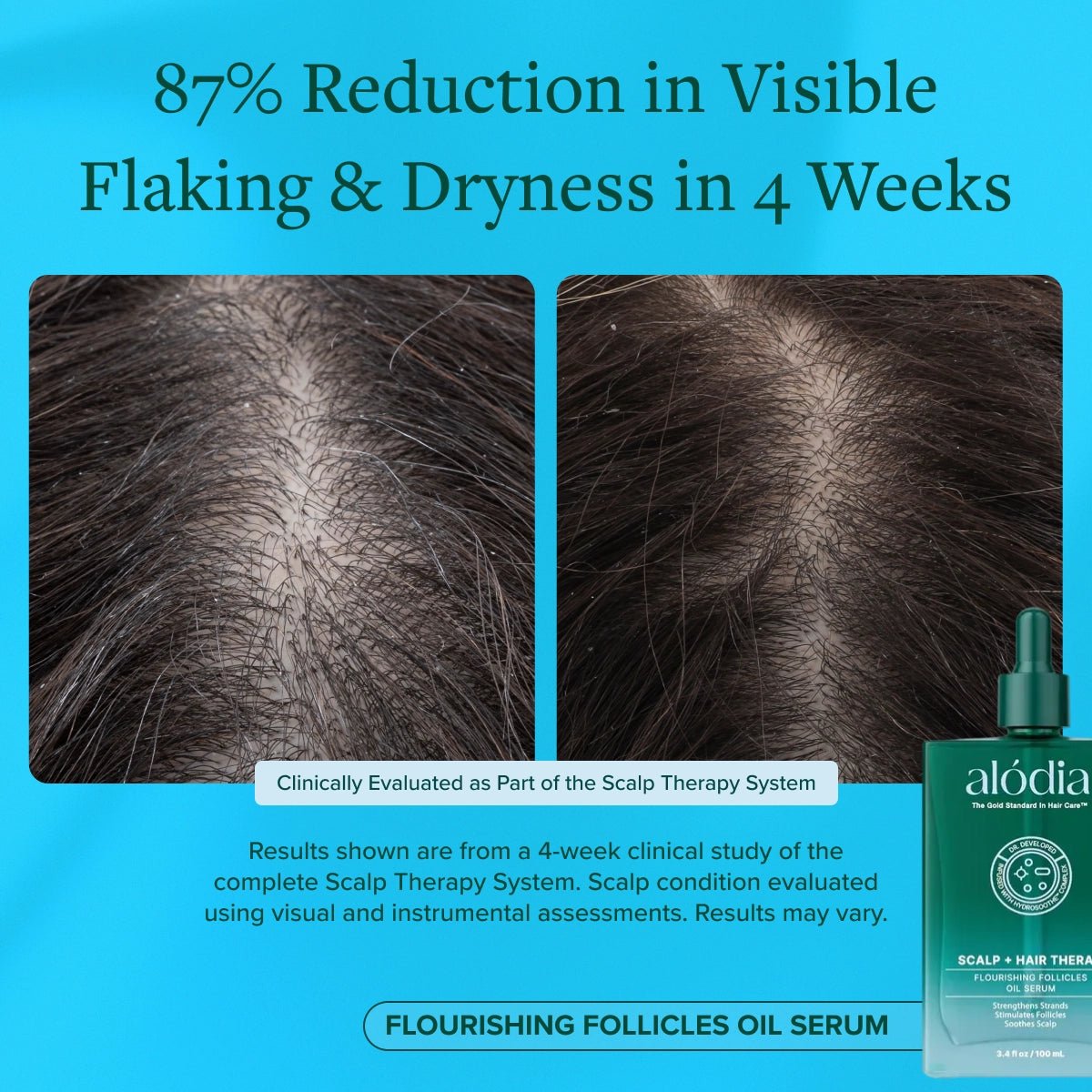Flourishing Follicles Oil Serum - Alodia Hair Care