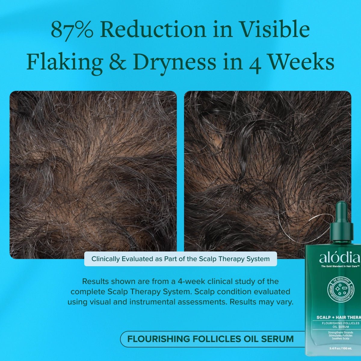 Flourishing Follicles Oil Serum - Alodia Hair Care