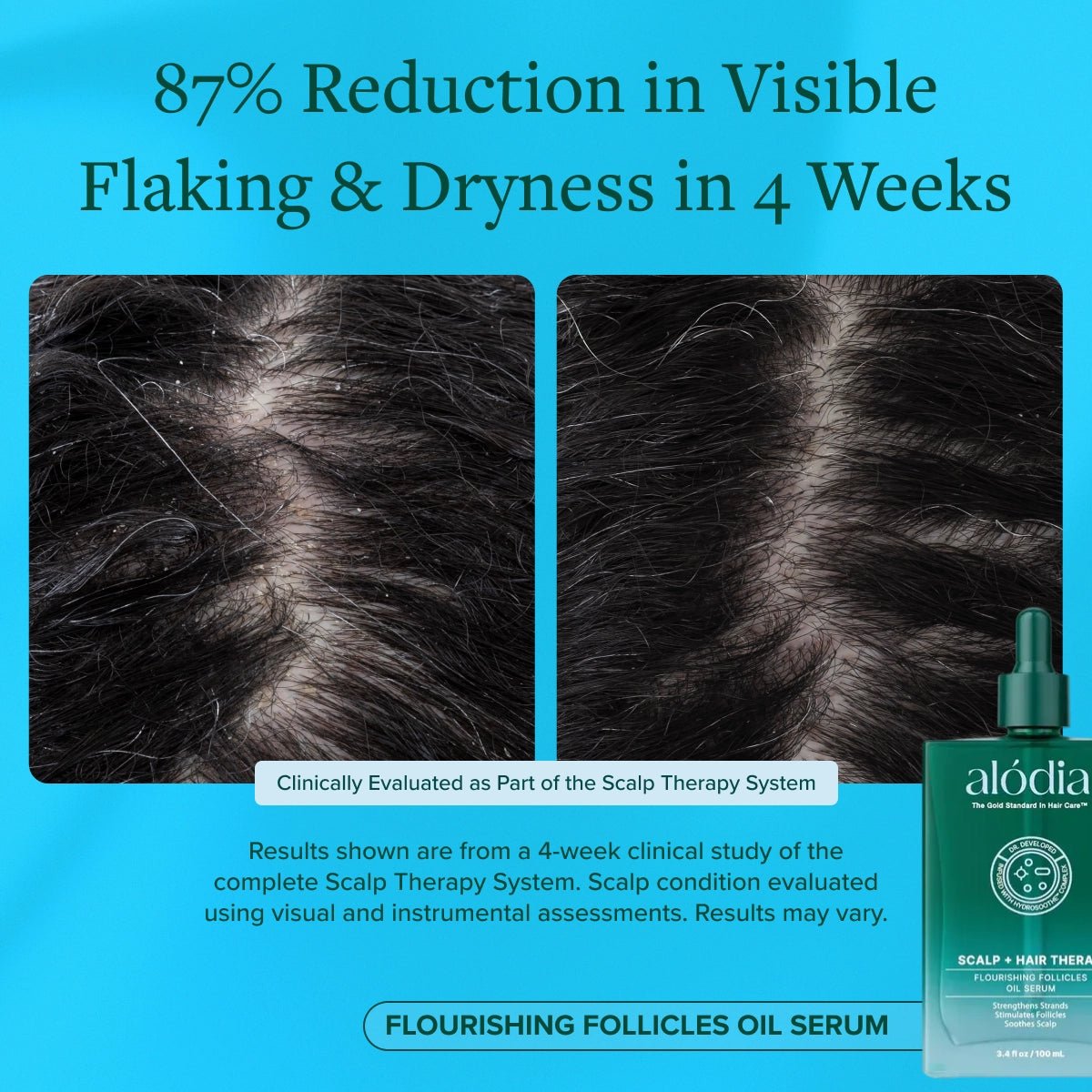 Flourishing Follicles Oil Serum - Alodia Hair Care