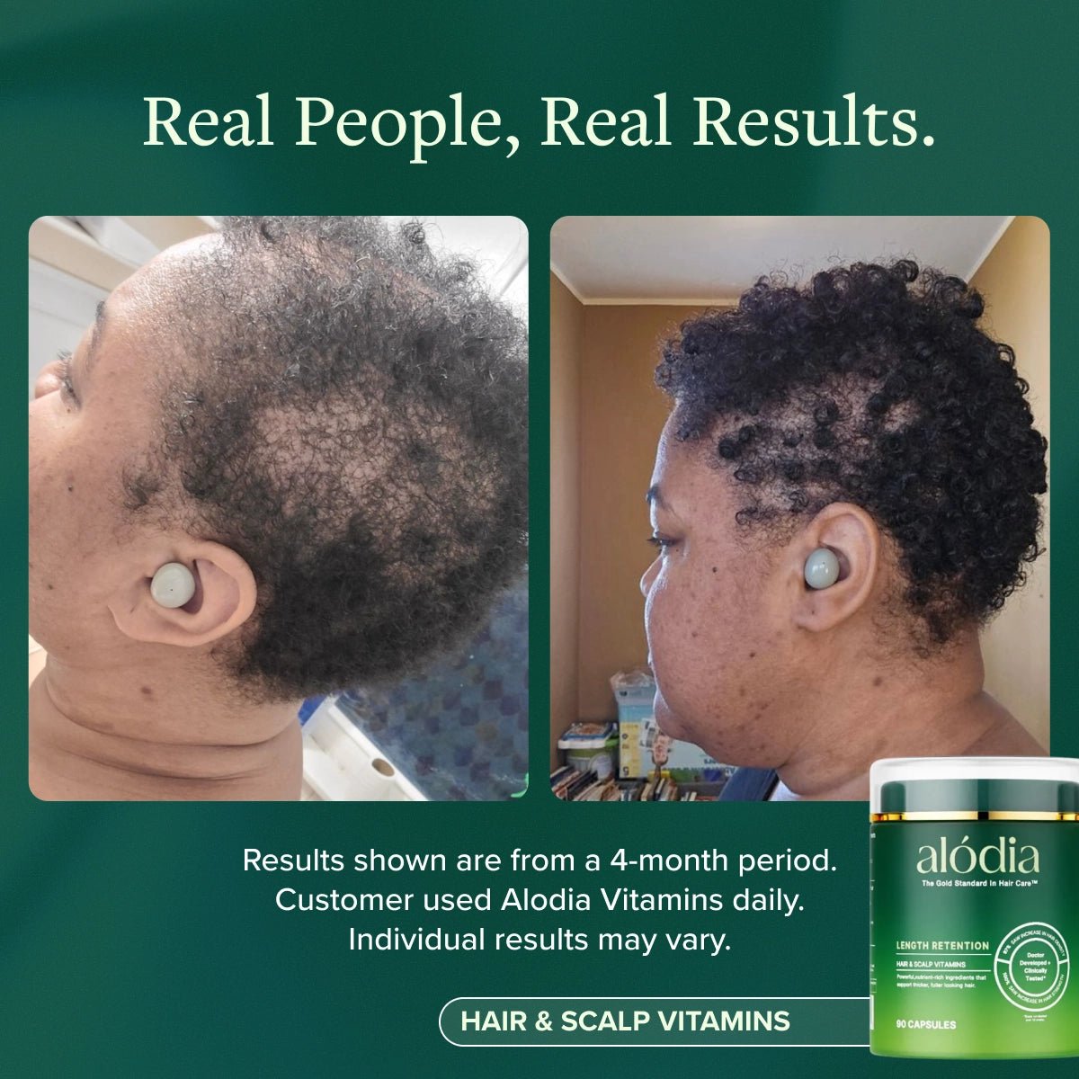 Hair & Scalp Vitamins - Alodia Hair Care