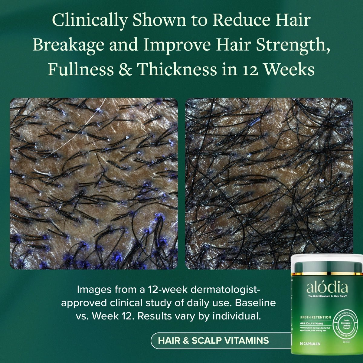 Hair & Scalp Vitamins - Alodia Hair Care