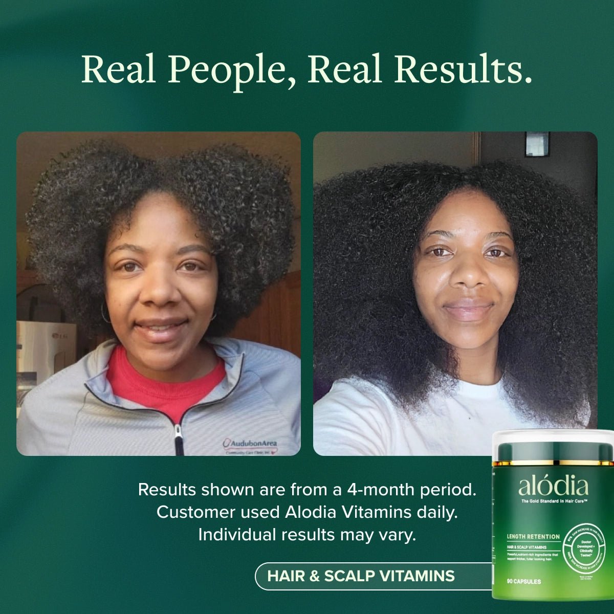 Hair & Scalp Vitamins - Alodia Hair Care