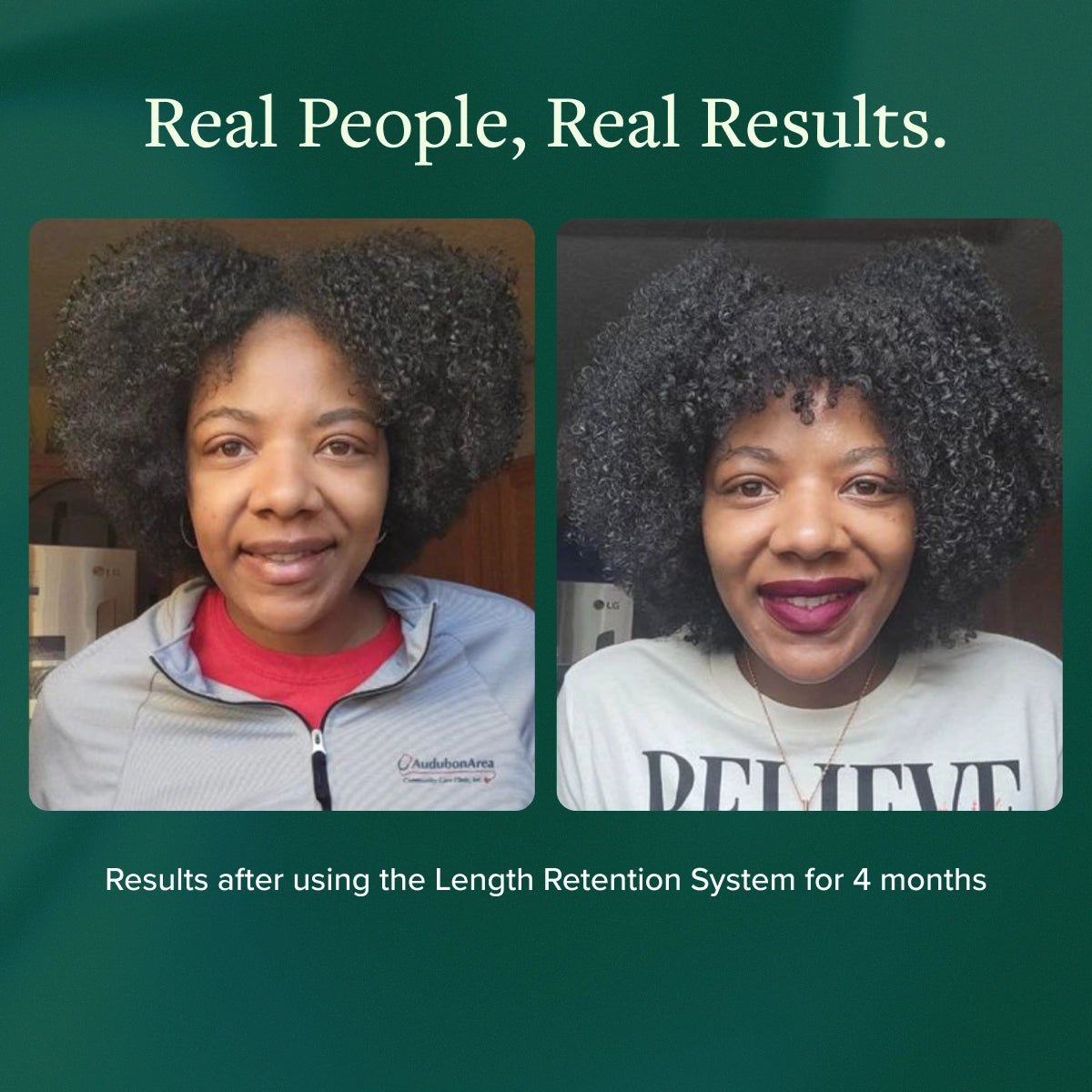 Length Retention System - Alodia Hair Care