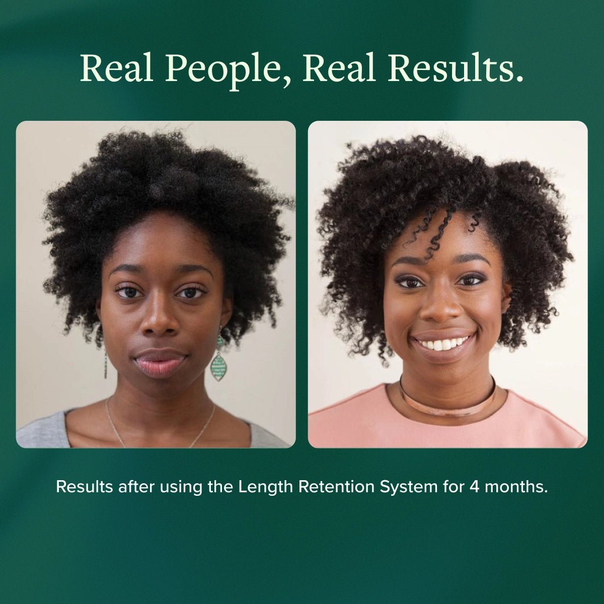 Length Retention System - Alodia Hair Care