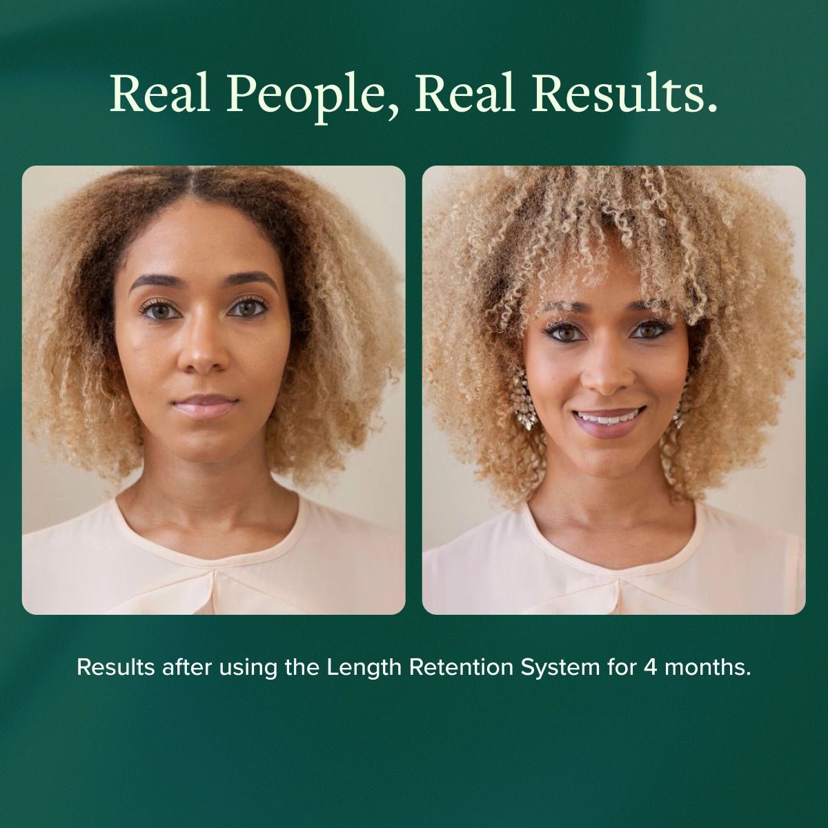 Length Retention System - Alodia Hair Care