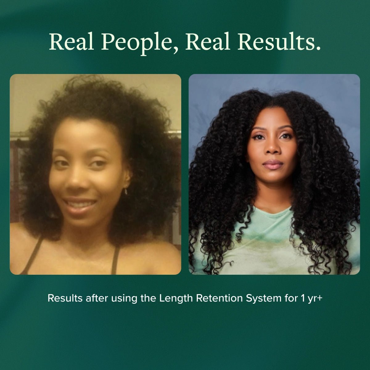 Length Retention System - Alodia Hair Care