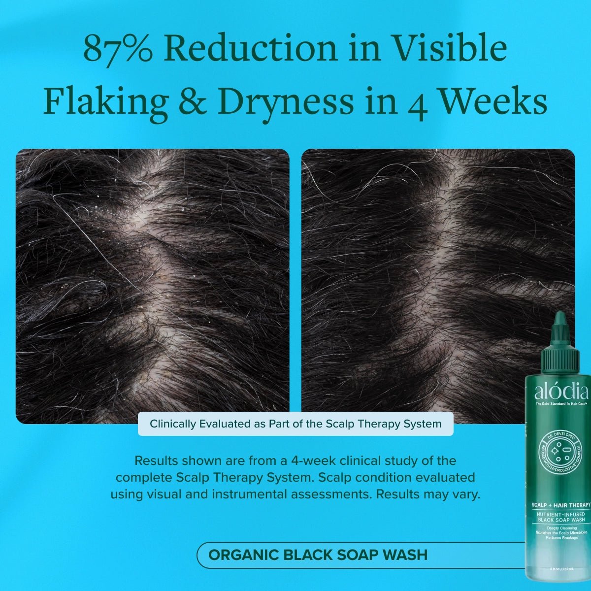 Nutrient Infused Organic Black Soap Wash - Alodia Hair Care