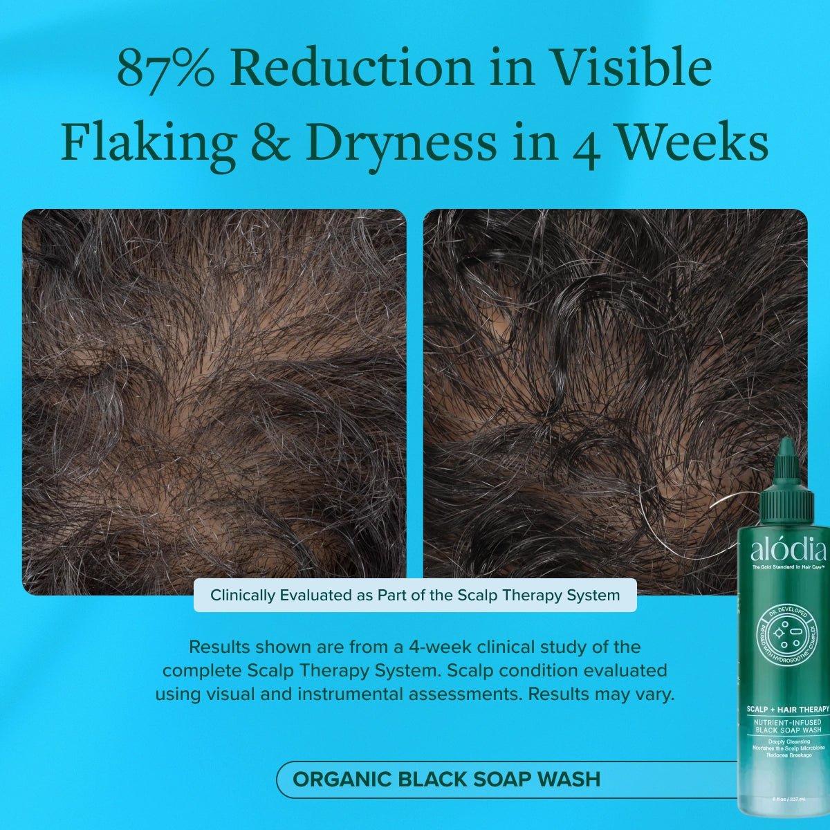 Nutrient Infused Organic Black Soap Wash - Alodia Hair Care