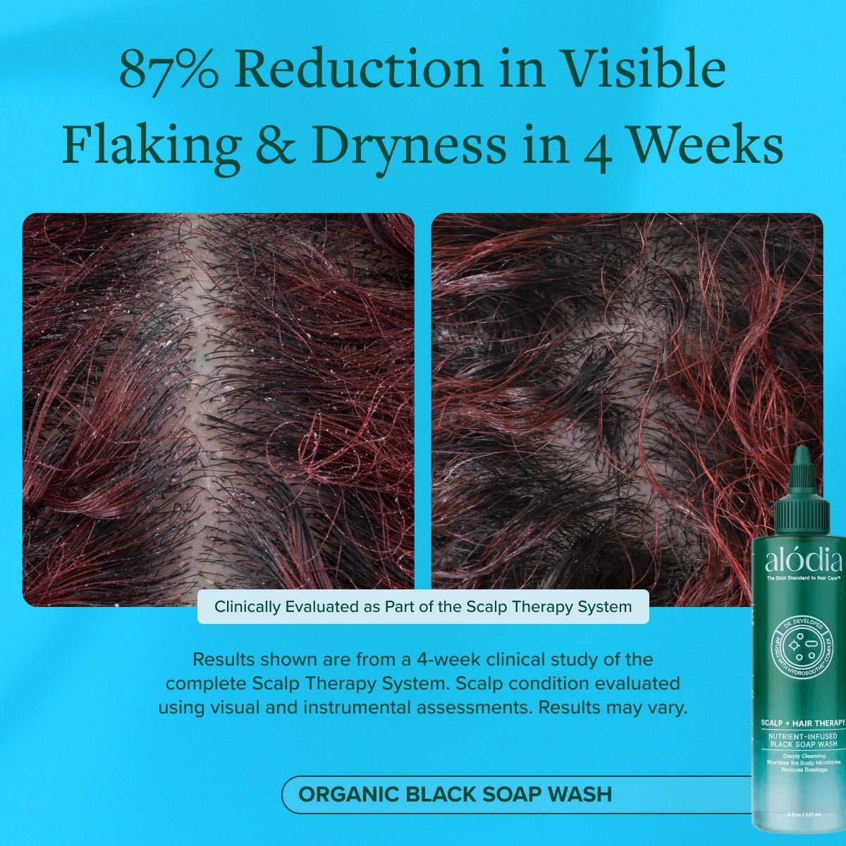 Nutrient Infused Organic Black Soap Wash - Alodia Hair Care