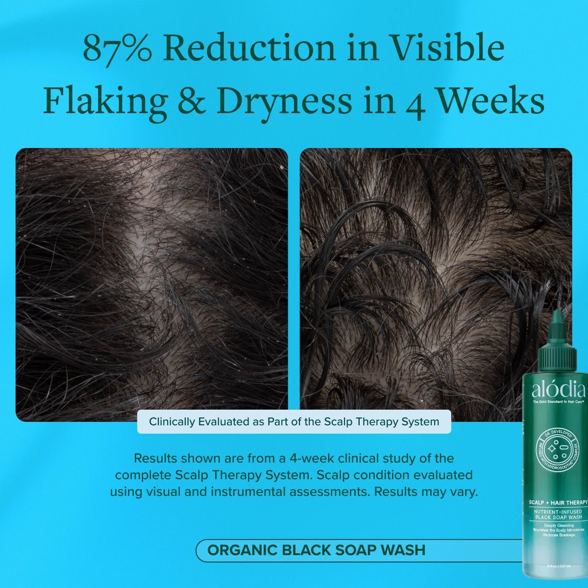 Nutrient Infused Organic Black Soap Wash - Alodia Hair Care